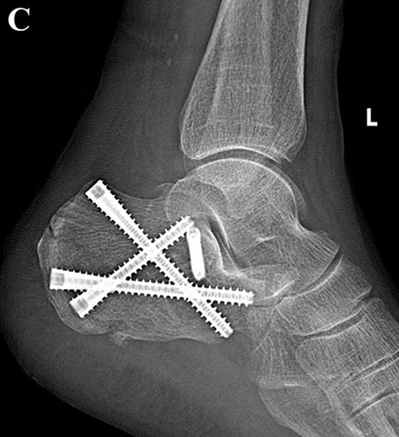 Fig. 3C