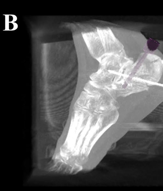 Fig. 2B